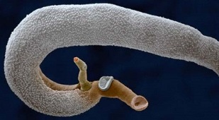 quels parasites peuvent vivre dans l'estomac humain
